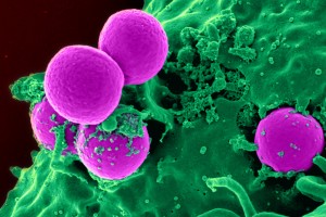 Tang - MRSA