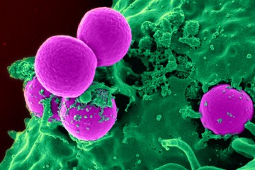 Tang - MRSA