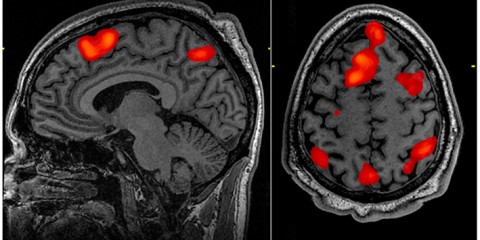 fMRI brain scan